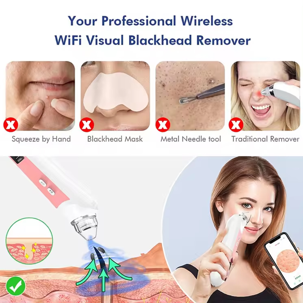 6 Hoofden Poriënreiniger Mee-E - Nasal Aspirator recensie en prijs